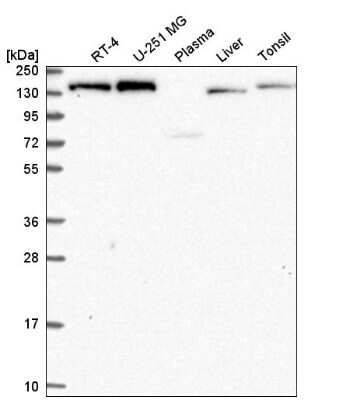 Western Blot: IKBKAP Antibody [NBP2-56082] - Western blot analysis in human cell line RT-4, human cell line U-251 MG, human plasma, human liver tissue and human tonsil tissue.