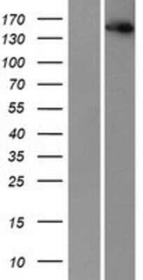 Western Blot: IKBKAP Overexpression Lysate (Adult Normal) [NBP2-07968] Left-Empty vector transfected control cell lysate (HEK293 cell lysate); Right -Over-expression Lysate for IKBKAP.