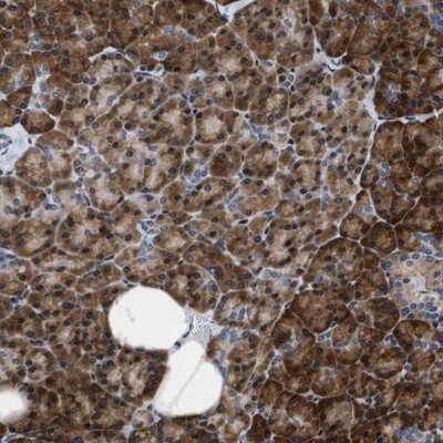 Immunohistochemistry-Paraffin: IKBKE Antibody [NBP1-83114] - Staining of human pancreas shows strong cytoplasmic positivity in exocrine glandular cells.