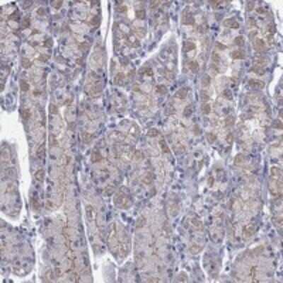 Immunohistochemistry-Paraffin: IKEPP Antibody [NBP3-17195] - Staining of human stomach shows strong cytoplasmic and membranous positivity in glandular cells.