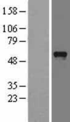 Western Blot: IKEPP Overexpression Lysate (Adult Normal) [NBL1-14270] Left-Empty vector transfected control cell lysate (HEK293 cell lysate); Right -Over-expression Lysate for IKEPP.
