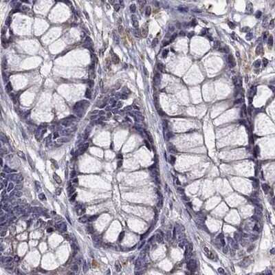 Immunohistochemistry-Paraffin: IKIP Antibody [NBP1-92022] - Staining of human colon.
