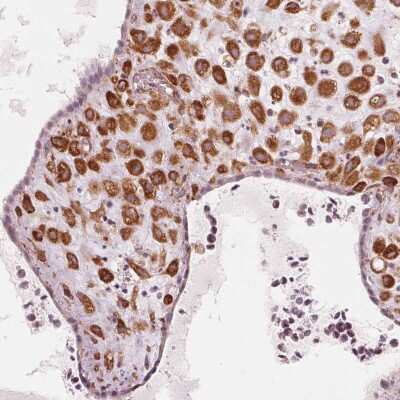 Immunohistochemistry-Paraffin: IKIP Antibody [NBP2-56525] - Staining of human placenta shows high expression.