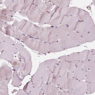 Immunohistochemistry-Paraffin: IKIP Antibody [NBP2-56525] - Staining of human skeletal muscle shows low expression as expected.