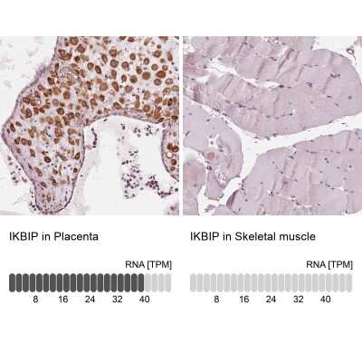 Immunohistochemistry-Paraffin: IKIP Antibody [NBP2-56525] - Staining in human placenta and skeletal muscle tissues using anti-IKBIP antibody. Corresponding IKBIP RNA-seq data are presented for the same tissues.