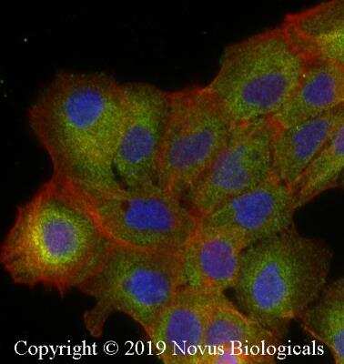 Immunocytochemistry/Immunofluorescence: IKK alpha Antibody (14A231) - Azide Free [NBP2-27409] - A431 cells were fixed for 10 minutes using 10% formalin and then permeabilized for 5 minutes using 1X PBS + 0.05% Triton X-100. The cells were incubated with anti-IKK alpha Antibody (14A231) at 2 ug/mL overnight at 4C and detected with an anti-mouse DyLight 488 (Green) at a 1:500 dilution. Actin was detected with Phalloidin 568 (Red) at a 1:200 dilution.  Nuclei were counterstained with DAPI (Blue).  Cells were imaged using a 40X objective.