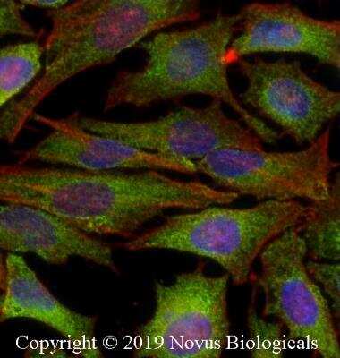 Immunocytochemistry/Immunofluorescence: IKK alpha Antibody (14A231) - Azide Free [NBP2-27409] - HeLa cells were fixed for 10 minutes using 10% formalin and then permeabilized for 5 minutes using 1X PBS + 0.05% Triton X-100. The cells were incubated with anti-IKK alpha Antibody (14A231) at 2 ug/mL overnight at 4C and detected with an anti-mouse DyLight 488 (Green) at a 1:500 dilution. Actin was detected with Phalloidin 568 (Red) at a 1:200 dilution. Nuclei were counterstained with DAPI (Blue). Cells were imaged using a 40X objective.