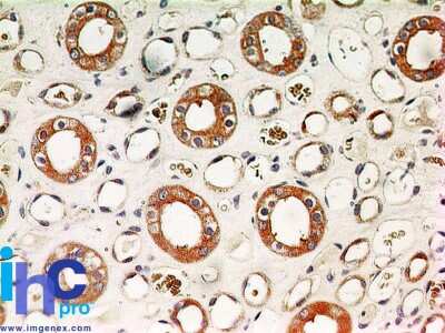 Immunohistochemistry-Paraffin: IKK alpha Antibody (14A231) - Azide Free [NBP2-27409] - FFPE human kidney stained with IKKa antibody at 5 ug/mL. Staining of formalin-fixed tissues is enhanced by boiling tissue sections in 10 mM sodium citrate buffer, pH 6.0 for 10-20 min followed by cooling at RT for 20 min.