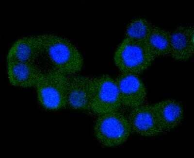 Immunocytochemistry/Immunofluorescence: IKK alpha Antibody (SN06-99) [NBP2-67651] - Staining IKK alpha in SW480 cells (green). The nuclear counter stain is DAPI (blue). Cells were fixed in paraformaldehyde, permeabilised with 0.25% Triton X100/PBS.