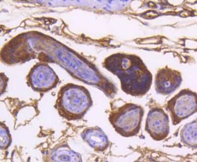 Immunohistochemistry-Paraffin: IKK alpha Antibody (SN06-99) [NBP2-67651] - Analysis of paraffin-embedded mouse skin tissue using anti-IKK alpha antibody. Counter stained with hematoxylin.