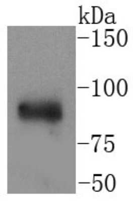 Western Blot: IKK alpha Antibody (SN06-99) [NBP2-67651] - Analysis of IKK alpha on Jurkat cells lysate using anti-IKK alpha antibody at 1/1,000 dilution.
