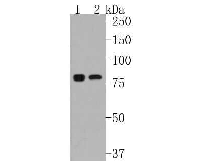 Western Blot: IKK alpha Antibody (SN06-99) [NBP2-67651] - Western blot analysis of IKK alpha on different lysates. Proteins were transferred to a PVDF membrane and blocked with 5% BSA in PBS for 1 hour at room temperature. The primary antibody (1/500) was used in 5% BSA at room temperature for 2 hours. Goat Anti