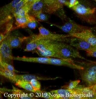 Immunocytochemistry/Immunofluorescence: IKK beta Antibody (10AG2) - Azide and BSA Free [NBP2-80788] - U-87 cells were fixed for 10 minutes using 10% formalin and then permeabilized for 5 minutes using 1X PBS + 0.5% Triton-X100. The cells were incubated with anti-IKK beta Antibody (10AG2) at 2 ug/ml overnight at 4C and detected with an anti-mouse Dylight 488 (Green) at a 1:500 dilution. Actin was detected with Phalloidin 568 (Red) at a 1:500 dilution. Nuclei were counterstained with DAPI (Blue). Cells were imaged using a 40X objective. Image from the standard format of this antibody.