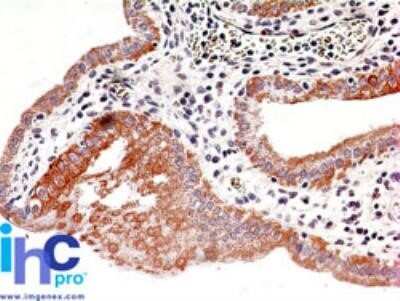 Immunohistochemistry-Paraffin: IKK beta Antibody (10AG2) - Azide and BSA Free [NBP2-80788] - Human gall bladder probed with IKKbeta antibody at 5 ug/ml. Human tissue TMA was used for this test. Staining of formalin-fixed tissues is enhanced by boiling tissue sections in 10 mM sodium citrate buffer, pH 6.0 for 10-20 min followed by cooling at RT f