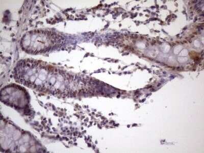 Immunohistochemistry: IKK epsilon/IKBKE Antibody (3C5) [NBP2-46047] - Analysis of Human colon tissue. (Heat-induced epitope retrieval by 1 mM EDTA in 10mM Tris, pH8.5, 120C for 3min)