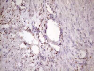 Immunohistochemistry: IKK epsilon/IKBKE Antibody (3C5) [NBP2-46047] - Analysis of Human endometrium tissue. (Heat-induced epitope retrieval by 1 mM EDTA in 10mM Tris, pH8.5, 120C for 3min)