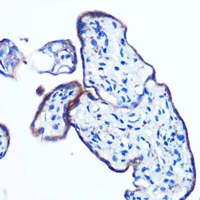 Immunohistochemistry-Paraffin IKK epsilon/IKBKE Antibody (5N4J8)