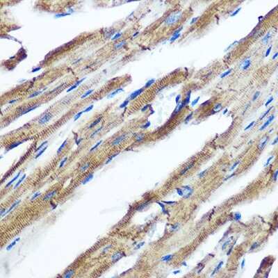 Immunohistochemistry-Paraffin IKK epsilon/IKBKE Antibody (5N4J8)