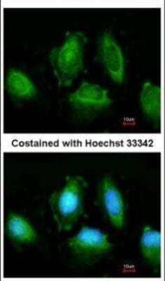 Immunocytochemistry/Immunofluorescence: IKK epsilon/IKBKE Antibody [NBP1-33052] - Analysis of methanol-fixed HeLa, using IKBKE antibody at 1:200 dilution.