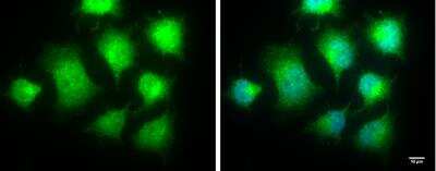 Immunocytochemistry/Immunofluorescence: IKK epsilon/IKBKE Antibody [NBP1-33052] - HeLa cells were fixed in 4% paraformaldehyde for 10 min. Green: IKBKE protein stained by IKBKE antibody [C2C3], C-term diluted at 1:100. Blue: Hoechst 33342 staining. Scale bar = 10 um.