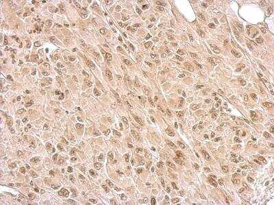 Immunohistochemistry-Paraffin: IKK epsilon/IKBKE Antibody [NBP1-33052] - Paraffin-embedded U87 xenograft; antibody dilution 1:500.