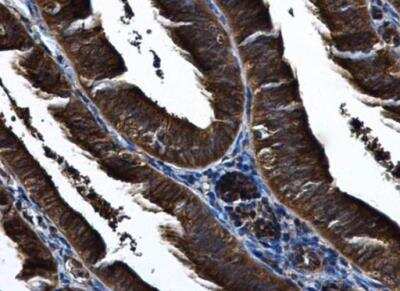 Immunohistochemistry-Paraffin: IKK epsilon/IKBKE Antibody [NBP1-33052] - Paraffin-embedded human endometrium.  IKBKE antibody [C2C3], C-term diluted at 1:500.