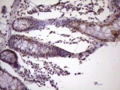 Immunohistochemistry: IKK epsilon/IKBKE Antibody (OTI3C5) - Azide and BSA Free [NBP2-71490] - Analysis of Human colon tissue. (Heat-induced epitope retrieval by 1 mM EDTA in 10mM Tris, pH8.5, 120C for 3min)