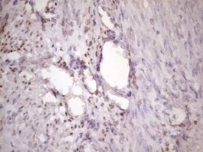 Immunohistochemistry: IKK epsilon/IKBKE Antibody (OTI3C5) - Azide and BSA Free [NBP2-71490] - Analysis of Human endometrium tissue. (Heat-induced epitope retrieval by 1 mM EDTA in 10mM Tris, pH8.5, 120C for 3min)