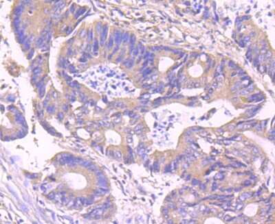 Immunohistochemistry-Paraffin: IKK gamma Antibody (JA11-83) [NBP2-66904] - Analysis of paraffin-embedded human colon tissue using anti-IKK gamma antibody. Counter stained with hematoxylin.