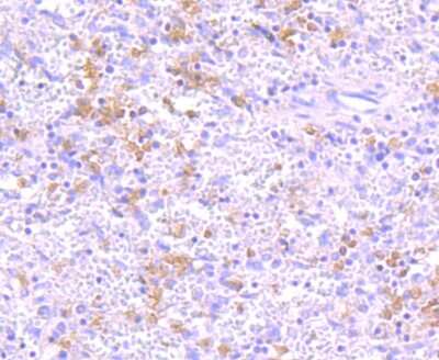 Immunohistochemistry-Paraffin: IKK gamma Antibody (JA11-83) [NBP2-66904] - Analysis of paraffin-embedded human spleen tissue using anti-IKK gamma antibody. Counter stained with hematoxylin.