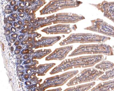 Immunohistochemistry-Paraffin: IKK gamma Antibody (JA11-83) [NBP2-66904] - Analysis of paraffin-embedded mouse colon tissue with Rabbit anti-IKK gamma antibody washed with ddH2O and PBS, and then probed with the primary antibody  at 1/400 dilution for 1 hour at room temperature. The detection was performed using an HRP conjugated compact polymer system. DAB was used as the chromogen. Tissues were counterstained with hematoxylin and mounted with DPX.