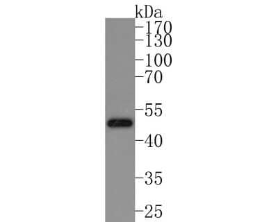 Western Blot: IKK gamma Antibody (JA11-83) [NBP2-66904] - Analysis of IKK gamma on Hela cell lysates. Proteins were transferred to a PVDF membrane and blocked with 5% BSA in PBS for 1 hour at room temperature. The primary antibody (1/500) was used in 5% BSA at room temperature for 2 hours. Goat Anti-Rabbit IgG - HRP Secondary Antibody at 1:200,000 dilution was used for 1 hour at room temperature. Predicted band size: 48 kDa Observed band size: 48 kDa