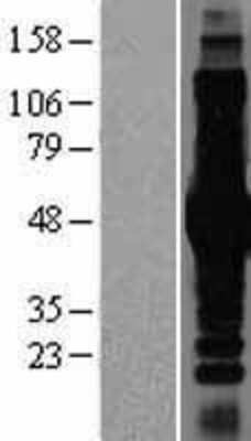 Western Blot: IKK-gamma Overexpression Lysate (Adult Normal) [NBP2-10944] Left-Empty vector transfected control cell lysate (HEK293 cell lysate); Right -Over-expression Lysate for IKK-gamma.