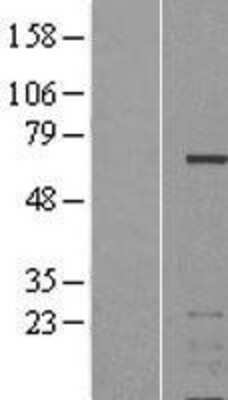 Western Blot: Aiolos/IKZF3 Overexpression Lysate [NBL1-11893] -  Left-Empty vector transfected control cell lysate (HEK293 cell lysate); Right -Over-expression Lysate for IKZF3.