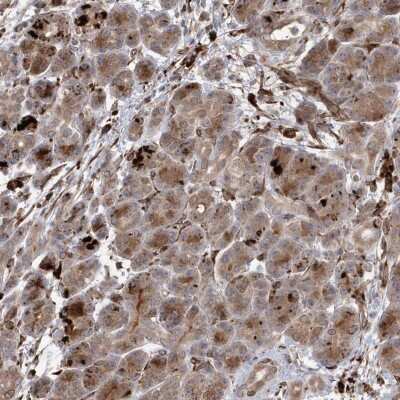 Immunohistochemistry-Paraffin: IL1RAPL2 Antibody [NBP2-38282] - Staining of human pancreas shows strong cytoplasmic positivity in fraction of exocrine glandular cells.