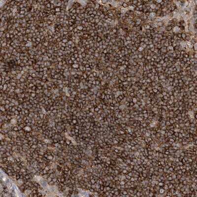 Immunohistochemistry-Paraffin: IL-1 RAPL2/IL-1 R9 Antibody [NBP1-81598] - Staining of human lymph node shows strong cytoplasmic positivity in lymphoid cells outside reaction centra.