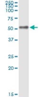Immunoprecipitation: IL-1 RAcP/IL-1 R3 Antibody (2A3) [H00003556-M06] - Analysis of IL1RAP transfected lysate using anti-IL1RAP monoclonal antibody and Protein A Magnetic Bead, and immunoblotted with IL1RAP rabbit polyclonal antibody.