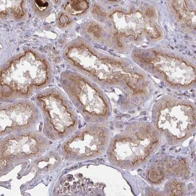 Immunohistochemistry-Paraffin: IL-1 RI Antibody [NBP2-48500] - Staining of human kidney shows moderate cytoplasmic and membranous positivity in cells in tubules.