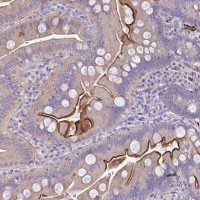 Immunohistochemistry: IL-1 RI Antibody [NBP2-48589] - Staining of human small intestine shows strong luminal membranous positivity in glandular cells.