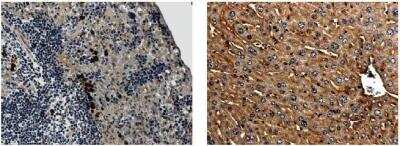 Immunohistochemistry-Paraffin: IL-1 RII Antibody (RM0014-7D7) [NB110-85472] - IL1RII immunohistochemistry staining of paraffin sections of mouse Spleen and liver tissues from LPS exposed animals.