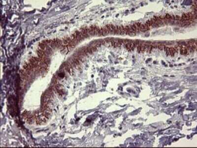 Immunohistochemistry: IL-1 alpha/IL-1F1 Antibody (OTI2F8) - Azide and BSA Free [NBP2-71021] - Analysis of Human breast tissue. (Heat-induced epitope retrieval by 10mM citric buffer, pH6.0, 120C for 3min)