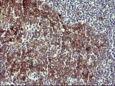 Immunohistochemistry: IL-1 alpha/IL-1F1 Antibody (OTI2F8) - Azide and BSA Free [NBP2-71021] - Analysis of Human lymph node tissue. (Heat-induced epitope retrieval by 10mM citric buffer, pH6.0, 120C for 3min)