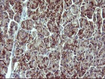 Immunohistochemistry: IL-1 alpha/IL-1F1 Antibody (OTI2F8) - Azide and BSA Free [NBP2-71021] - Analysis of Human pancreas tissue. (Heat-induced epitope retrieval by 10mM citric buffer, pH6.0, 120C for 3min)