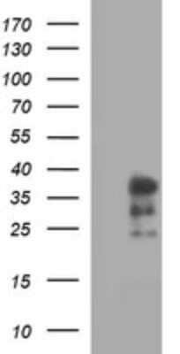 Western Blot: IL-1 alpha/IL-1F1 Antibody (OTI2F8) - Azide and BSA Free [NBP2-71021] - Analysis of HEK293T cells lysate (5 ug, left lane) and full length human recombinant protein of human IL-1 alpha (NP_000566) produced in Analysis of HEK293T cell (5 ug, right lane).