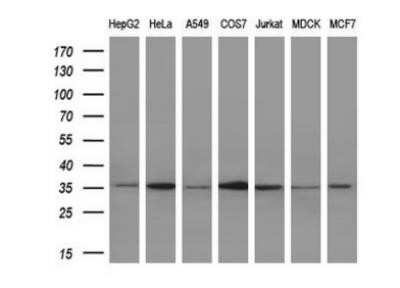 Western Blot: IL-1 alpha/IL-1F1 Antibody (OTI2F8) - Azide and BSA Free [NBP2-71021] - Analysis of extracts (10ug) from 5 different cell lines by using anti-IL1A monoclonal antibody. (1:200)