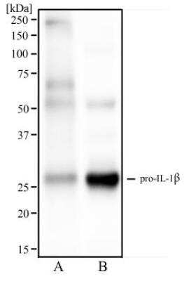 Western Blot: IL-1 beta/IL-1F2 Antibody (43N1F9) [NBP2-27340] - Analysis of human spleen tissue (A) and human tonsil tissue (B) using IL1 beta antibody at 2 ug/ml.