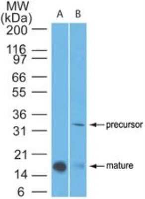 Western Blot: IL-1 beta/IL-1F2 Antibody (43N1G6) - Azide and BSA Free [NBP2-80791] - Analysis of IL-1beta in A) full-length recombinant protein and B) human spleen lysate using IL-1beta antibody. Goat anti-mouse Ig HRP secondary antibody and PicoTect ECL substrate solution were used for this test. Image from the standard format of this antibody.