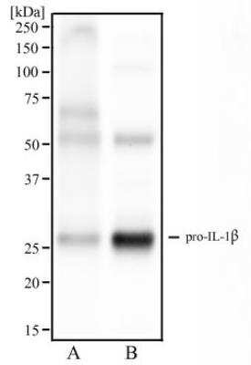 Western Blot: IL-1 beta/IL-1F2 Antibody (43N4C4) [NBP2-27343] - Analysis of human spleen tissue (A) and human tonsil tissue (B) using IL1 beta antibody at 2 ug/ml.
