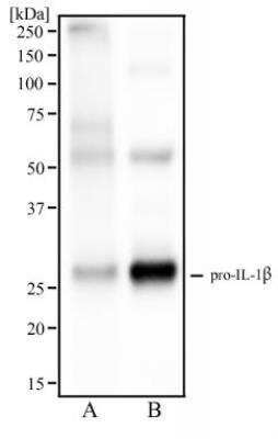Western Blot: IL-1 beta/IL-1F2 Antibody (43N8F6) [NBP2-27341] - Analysis of human spleen tissue (A) and human tonsil tissue (B) using IL1 beta antibody at 2 ug/mL.