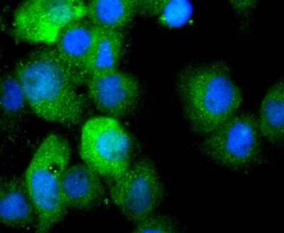 Immunocytochemistry/Immunofluorescence: IL-1 beta/IL-1F2 Antibody (JJ087-3) [NBP2-67865] - Staining IL1 beta in A431 cells (green). The nuclear counter stain is DAPI (blue). Cells were fixed in paraformaldehyde, permeabilised with 0.25% Triton X100/PBS.